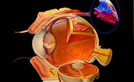 traitement-glaucome